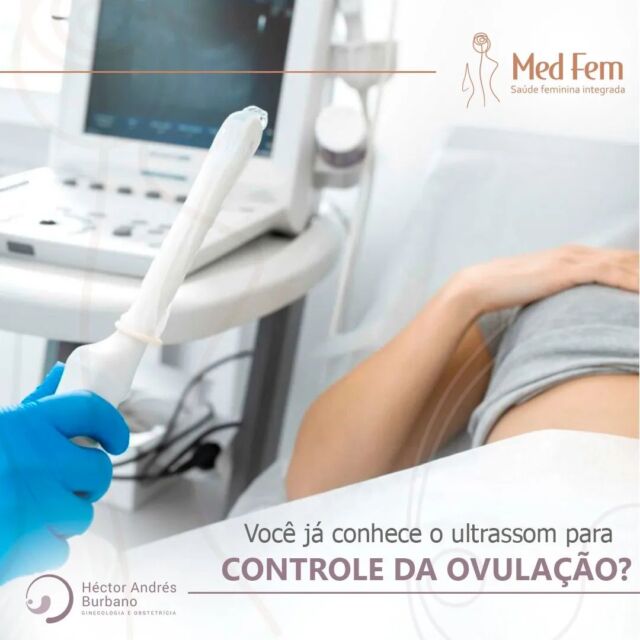 A ultrassonografia não é apenas uma ferramenta essencial durante a gravidez, mas também desempenha um papel crucial no controle da ovulação. Quero compartilhar como essa tecnologia pode ajudar quem está tentando engravidar.

🔹 O que é o ultrassom para controle de ovulação?
Este procedimento envolve a realização de ultrassonografias seriadas para monitorar o crescimento dos folículos ovarianos, responsáveis pela liberação dos óvulos durante o ciclo menstrual.

🔹 Como funciona?
Durante o ciclo menstrual, são realizadas ultrassonografias transvaginais em intervalos regulares para medir o tamanho dos folículos e avaliar o desenvolvimento endometrial. Com essas informações, é possível prever o momento da ovulação.

🔹 Benefícios:
Alta Precisão: Oferece dados precisos sobre a ovulação.
Personalizado: Cada mulher é única, e este método permite um acompanhamento personalizado do seu ciclo.

Se você está tentando engravidar ou precisa de ajuda para entender melhor seu ciclo menstrual, o ultrassom para controle da ovulação pode ser uma ferramenta valiosa. Agende uma consulta e vamos juntos encontrar o melhor caminho para realizar seu sonho de ser mãe.

#Ultrassom #ControleDeOvulação #Fertilidade #SaúdeDaMulher #DrHectorAndres #MedicinaFetal #novoselementos